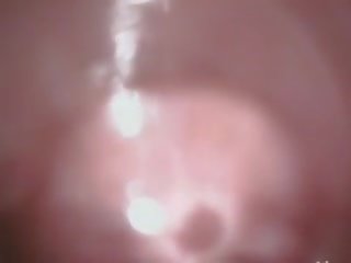 Дълбоко анално секс видео с космати японки жена