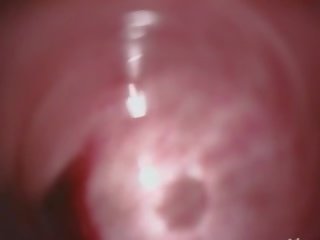 डीप एनल सेक्स क्लिप साथ हेरी कोरियन प्यारी